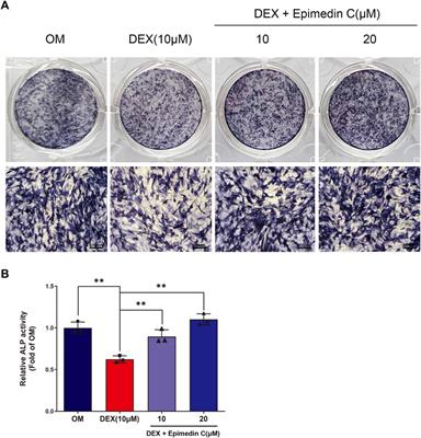 Epimedin C Alleviates Glucocorticoid-Induced Suppression of Osteogenic Differentiation by Modulating PI3K/AKT/RUNX2 Signaling Pathway